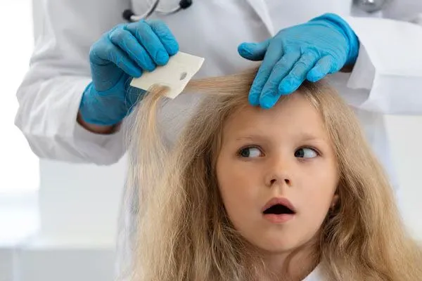 Alopecia nei bambini, è possibile?