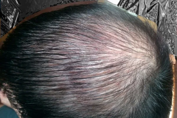 Pourquoi nos cheveux s’affaiblissent ?