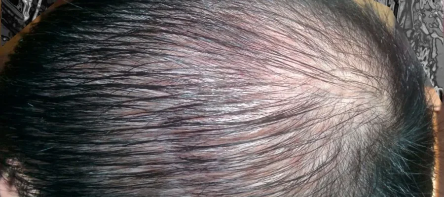 Pourquoi nos cheveux s’affaiblissent ? 1 Pourquoi nos cheveux s’affaiblissent ?