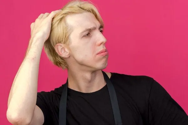 Come trattare l’alopecia nei giovani? 6 Come trattare l’alopecia nei giovani?