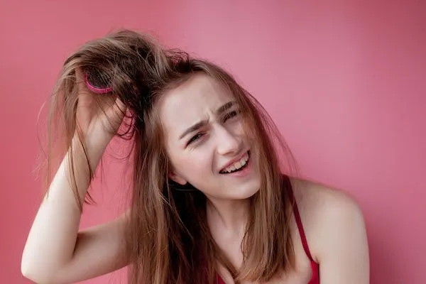 Alopecia seborroica: cause, sintomi e rimedi efficaci 1 Alopecia seborroica: cause, sintomi e rimedi efficaci