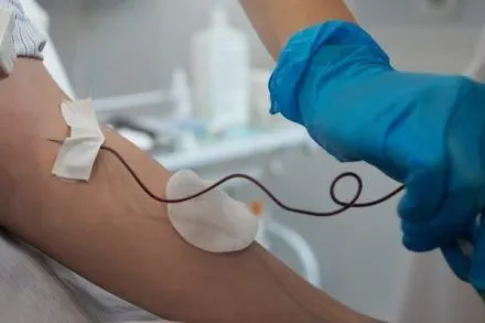 Le persone con anemia soffrono caduta dei capelli? 1 Le persone con anemia soffrono caduta dei capelli?