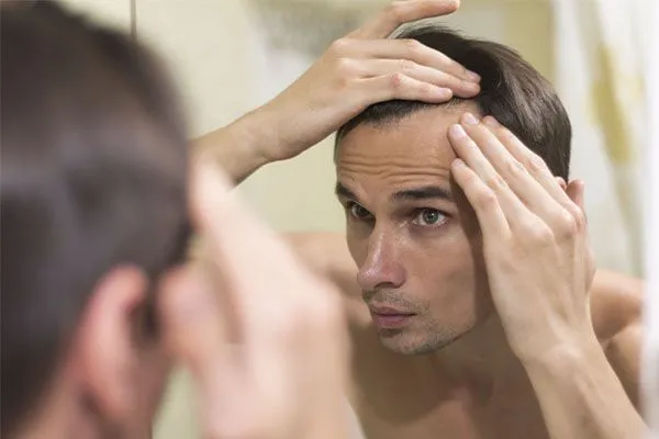 À quel âge commence la chute de cheveux ?