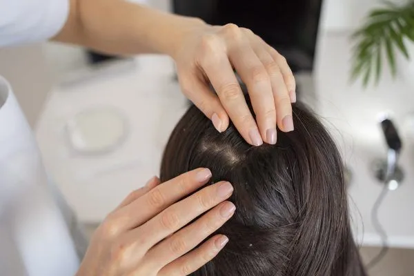Tricoscopia per la diagnosi dell’alopecia