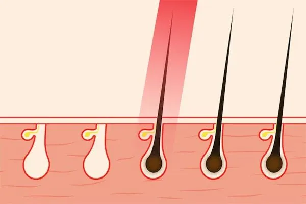 Come stimolare la crescita dei capelli? 4 Come stimolare la crescita dei capelli?