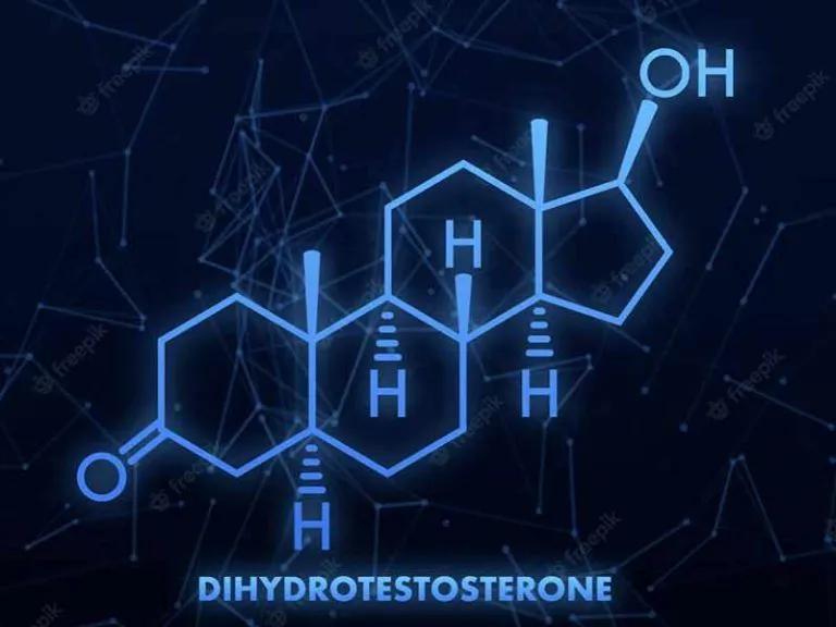 Testostérone et perte de cheveux : comprendre le lien hormonal