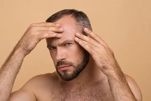Greffe de cheveux chez les célébrités : mythes, réalités et enseignements pour le grand public