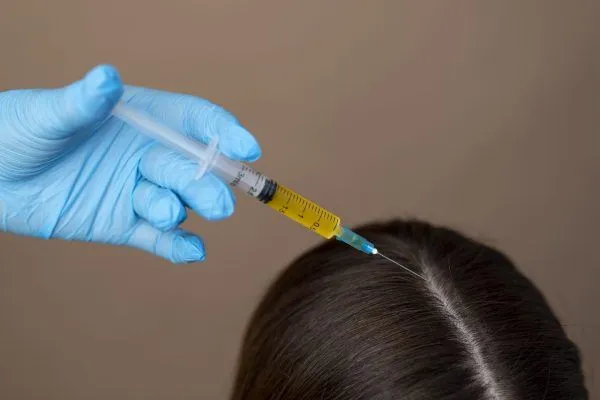 Mesoterapia per capelli: a cosa serve?
