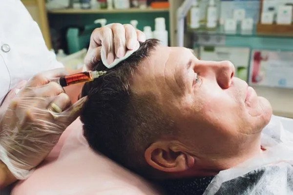 Tecniche di trapianto capelli: FUE, DHI, FUT