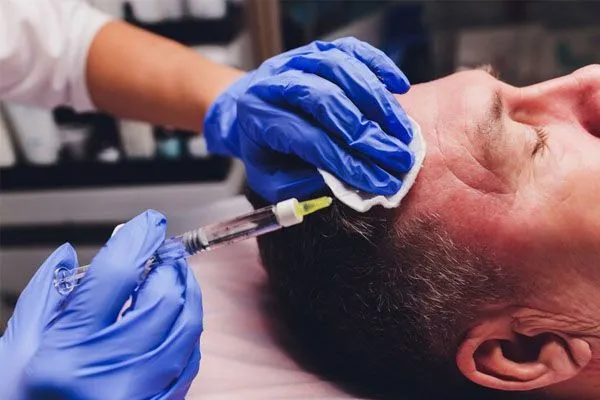 Tecniche di trapianto capelli: FUE, DHI, FUT
