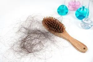 Guida completa agli esami per diagnosticare l’alopecia 3 Guida completa agli esami per diagnosticare l’alopecia