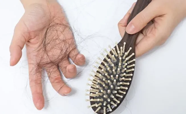 Chute de cheveux : causes, signes, diagnostic et solutions complètes