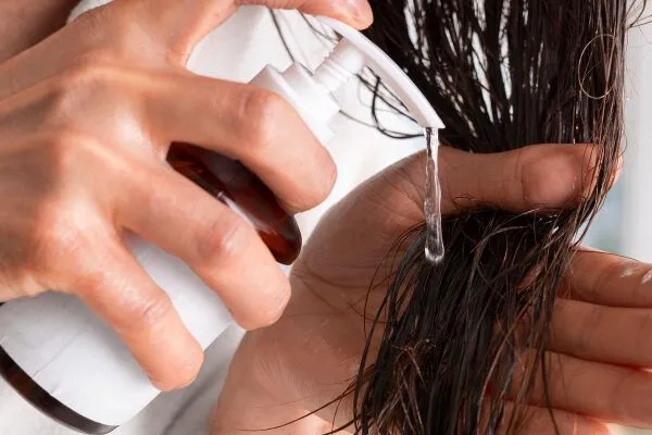 Alopecia seborroica: cause, sintomi e rimedi efficaci 5 Alopecia seborroica: cause, sintomi e rimedi efficaci