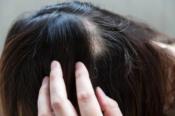 Cos’è un rigeneratore di capelli e dove trovarlo?