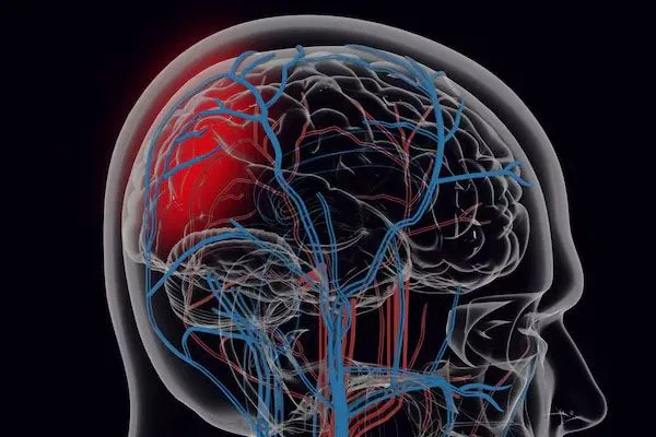 Relazione tra alopecia e circolazione sanguigna 2 Relazione tra alopecia e circolazione sanguigna