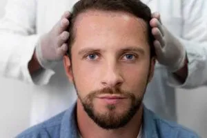 Trapianto capelli Roma prezzi: Guida ai costi e budget 2026