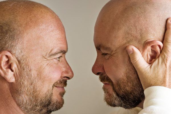 Trattamenti per l’Alopecia Areata: Cure Mediche e Terapie Disponibili 7 Trattamenti per l’Alopecia Areata: Cure Mediche e Terapie Disponibili