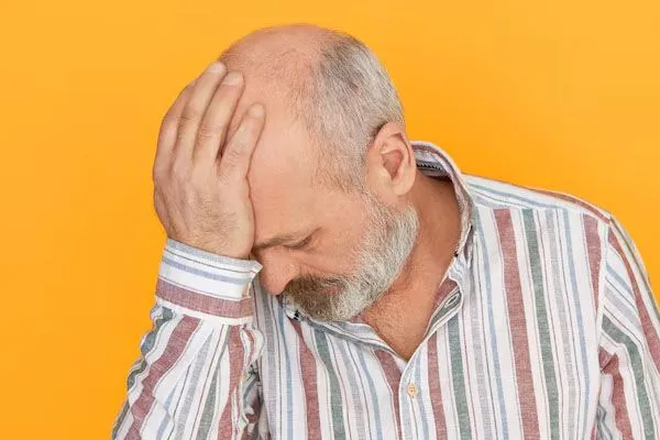 7 curiosità sull’alopecia che non sapevi 4 7 curiosità sull’alopecia che non sapevi